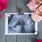 Baby announcement photos in Santa Barbra, CA.